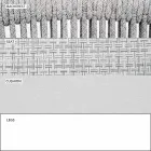 Kopsht lëkundës Kolltuku i ngurtë dhe pëlhurë e tundur - Smart nga Varaschin Viadurini